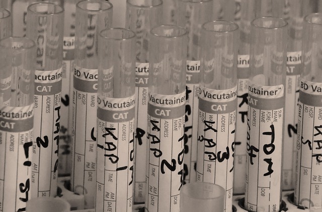 laboratory test tubes photo